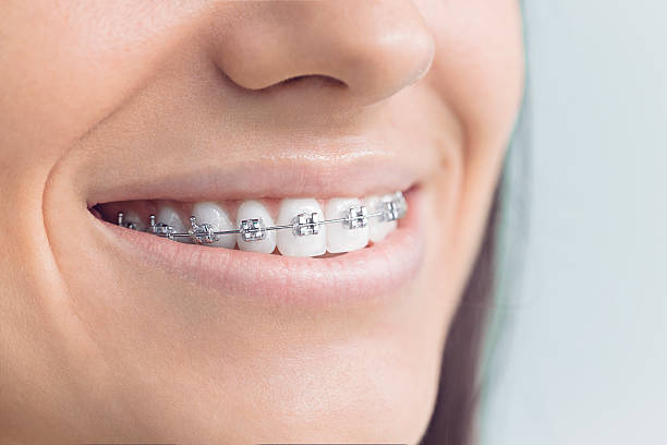 Best Invisalign and Clear Aligners  in Washburn, WI